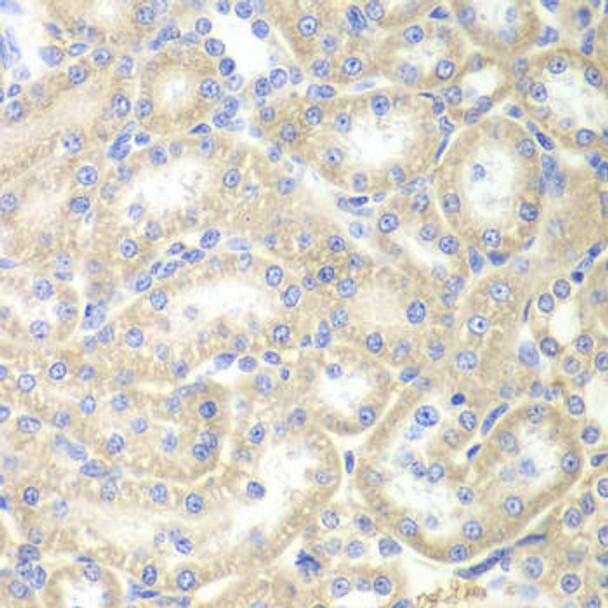Cell Cycle Antibodies 1 Anti-EPB41 Antibody CAB12434