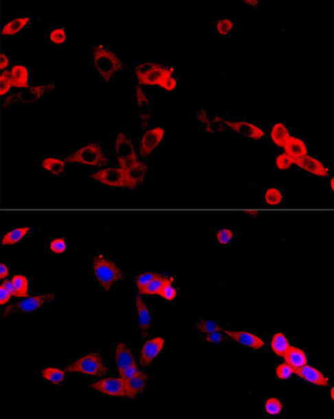 Cell Death Antibodies 1 Anti-FGFR2 Antibody CAB12436