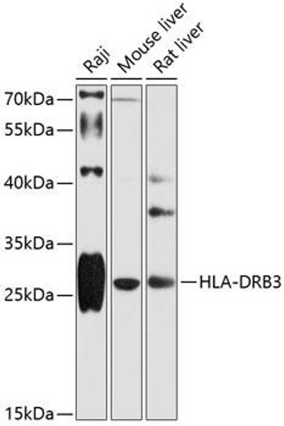 Immunology Antibodies 1 Anti-HLA-DRB3 Antibody CAB12444