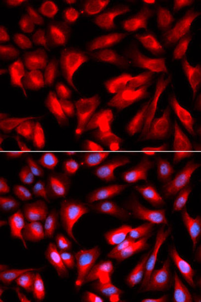 KO Validated Antibodies 1 Anti-HMMR Antibody CAB12445KO Validated