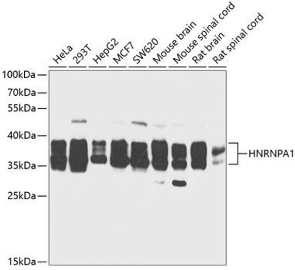 Immunology Antibodies 1 Anti-HNRNPA1 Antibody CAB12446