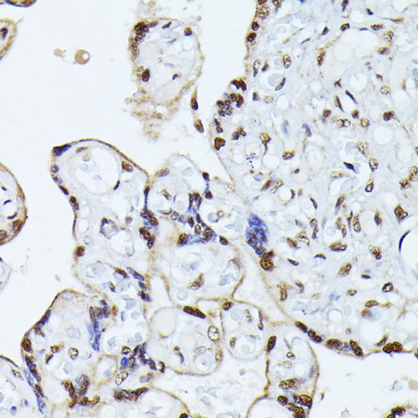 Cell Biology Antibodies 3 Anti-HNRNPL Antibody CAB12447