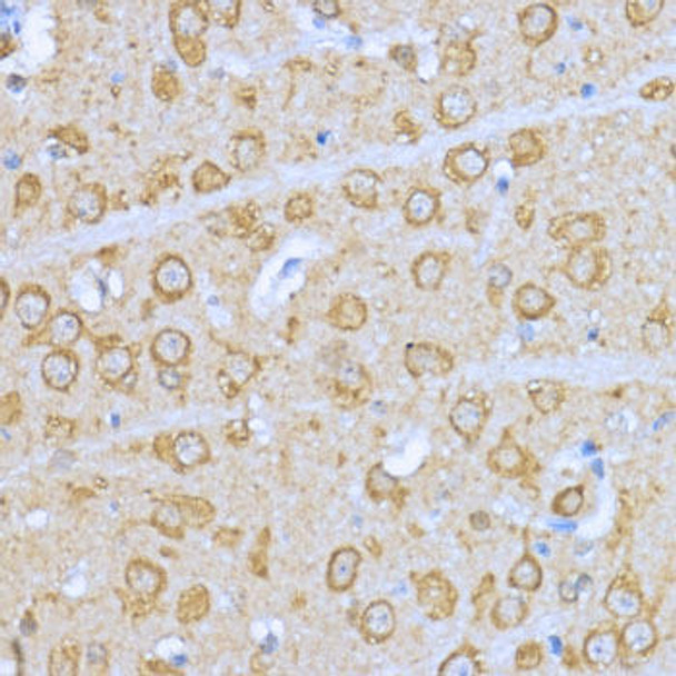 Immunology Antibodies 1 Anti-Hsp90 alpha Antibody CAB12448