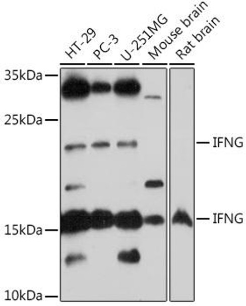 Immunology Antibodies 1 Anti-IFNG Antibody CAB12450