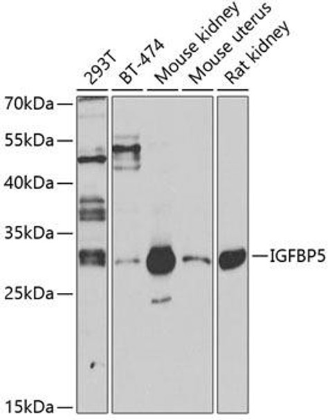 Cell Biology Antibodies 3 Anti-IGFBP5 Antibody CAB12451