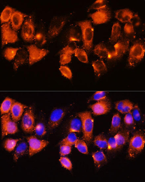 Cell Biology Antibodies 3 Anti-IGFBP5 Antibody CAB12451