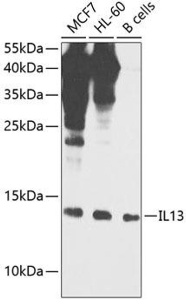 Cell Biology Antibodies 3 Anti-IL-13 Antibody CAB12453