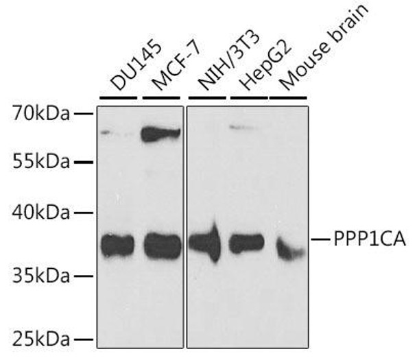 Metabolism Antibodies 1 Anti-PPP1CA Antibody CAB12468