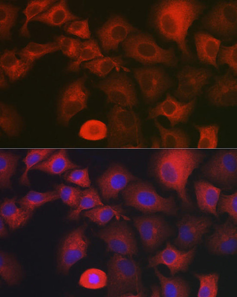 Signal Transduction Antibodies 1 Anti-MYO10 Antibody CAB12471