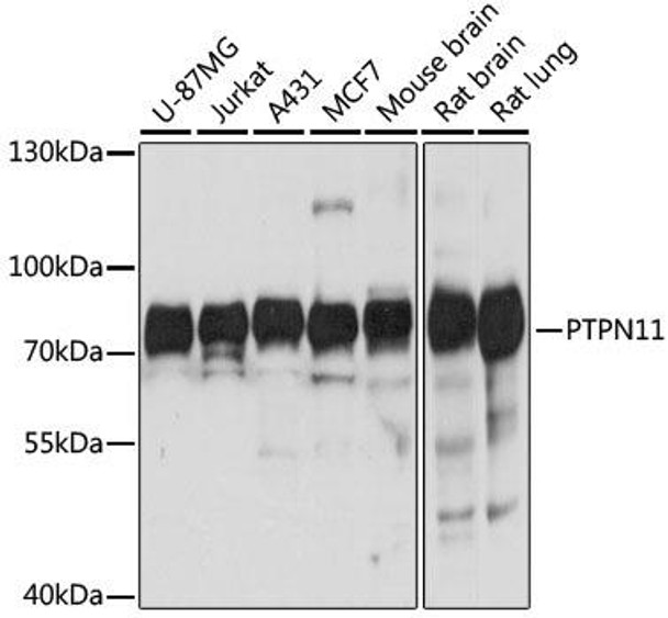 KO Validated Antibodies 1 Anti-PTPN11 Antibody CAB12486KO Validated