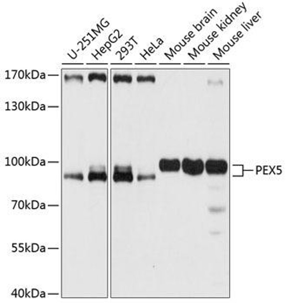 Cell Biology Antibodies 3 Anti-PEX5 Antibody CAB12493
