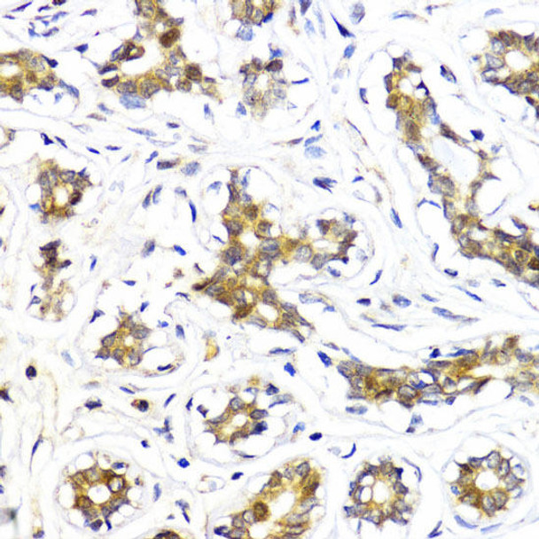 Cell Death Antibodies 1 Anti-Akt2 Antibody CAB1250