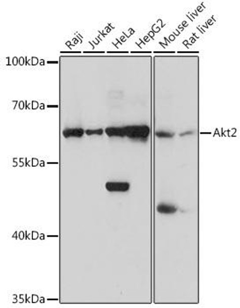 Cell Death Antibodies 1 Anti-Akt2 Antibody CAB1250