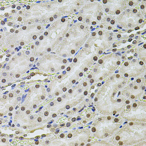 Immunology Antibodies 1 Anti-SET Antibody CAB12502