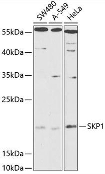 Immunology Antibodies 1 Anti-SKP1 Antibody CAB12505