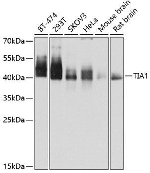 Cell Death Antibodies 1 Anti-TIA1 Antibody CAB12517