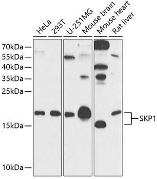 Immunology Antibodies 1 Anti-SKP1 Antibody CAB12518