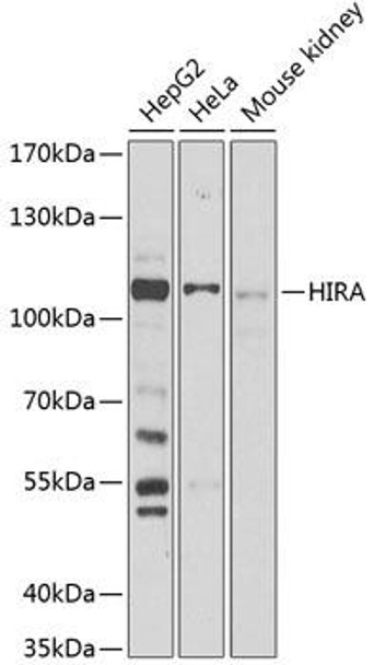 Epigenetics and Nuclear Signaling Antibodies 1 Anti-HIRA Antibody CAB12527