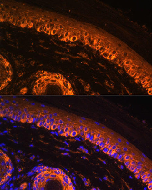 Metabolism Antibodies 1 Anti-TYR Antibody CAB1254