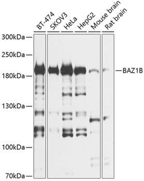 Epigenetics and Nuclear Signaling Antibodies 1 Anti-BAZ1B Antibody CAB12545