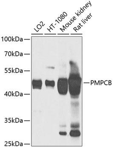 Cell Biology Antibodies 3 Anti-PMPCB Antibody CAB12549