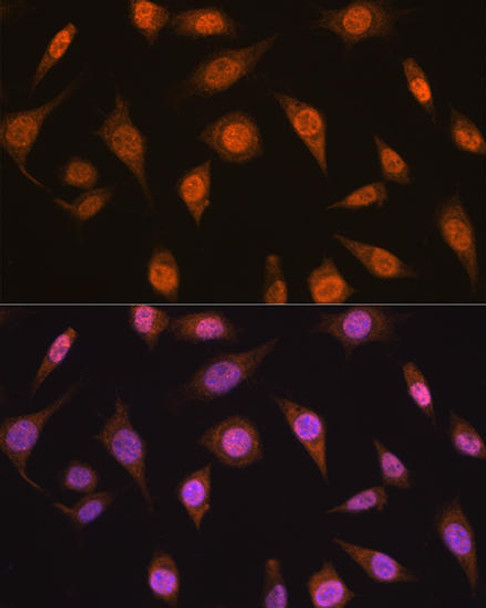 Cell Cycle Antibodies 1 Anti-MAD2L2 Antibody CAB12559