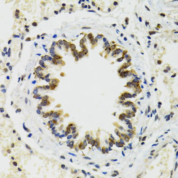 Epigenetics and Nuclear Signaling Antibodies 1 Anti-RUVBL2 Antibody CAB12564