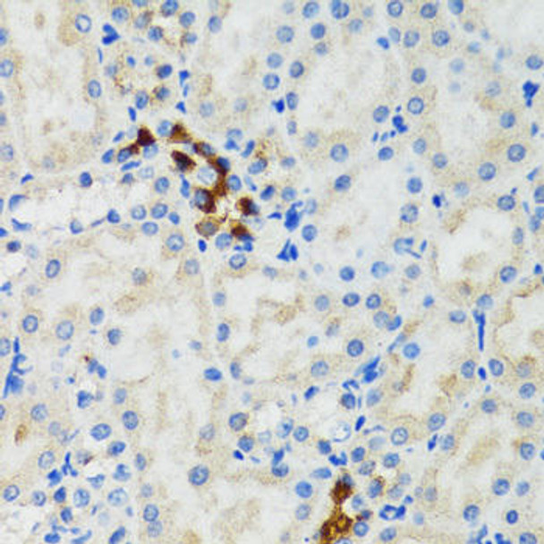 Cell Death Antibodies 1 Anti-GABARAP Antibody CAB12568