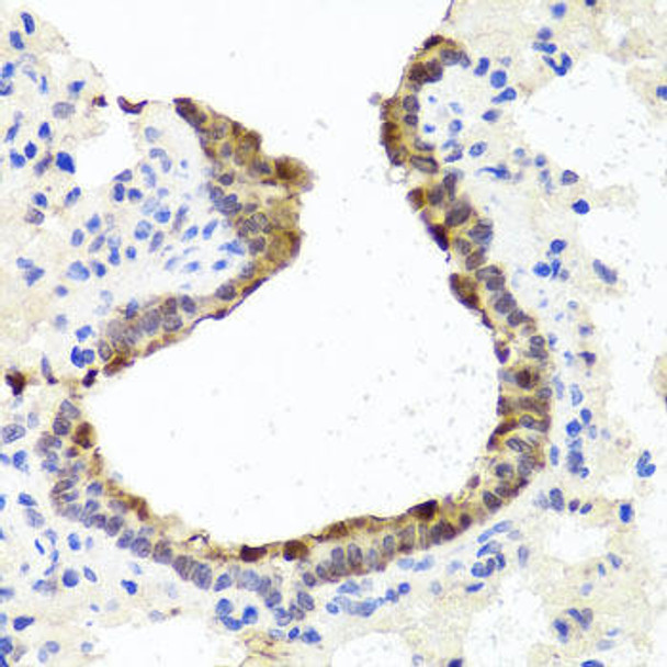 Epigenetics and Nuclear Signaling Antibodies 1 Anti-TOPBP1 Antibody CAB12574