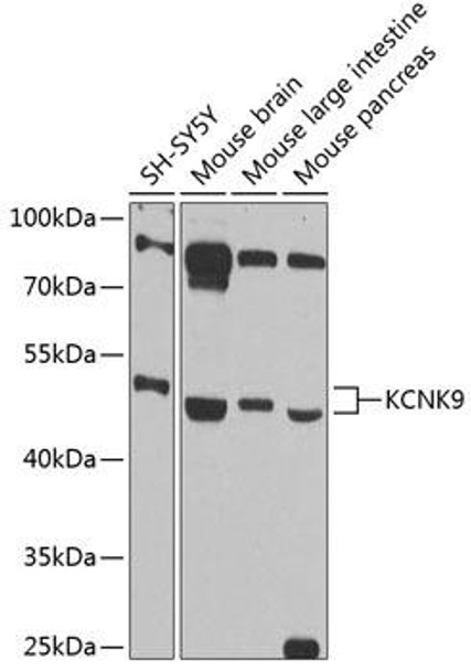 Signal Transduction Antibodies 1 Anti-KCNK9 Antibody CAB12583