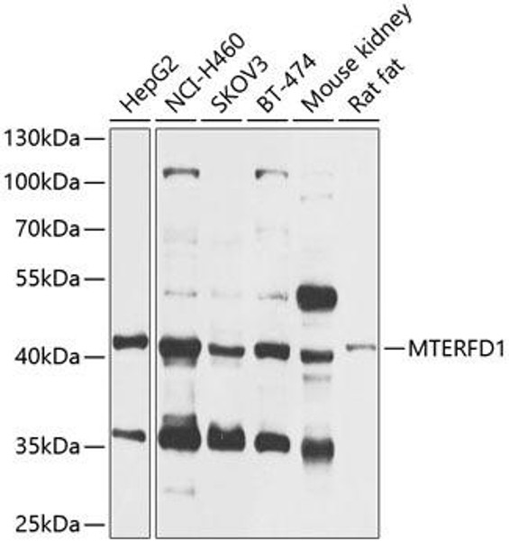 Cell Biology Antibodies 3 Anti-MTERFD1 Antibody CAB12585