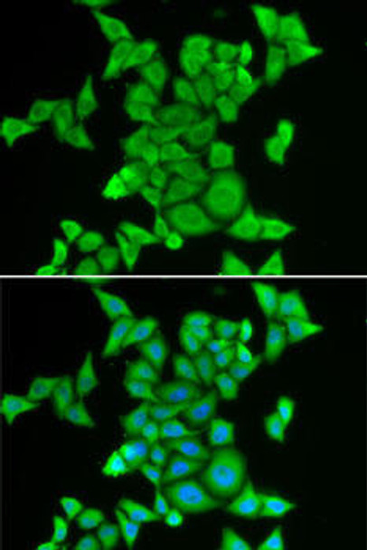 Cell Biology Antibodies 3 Anti-STRN3 Antibody CAB12586