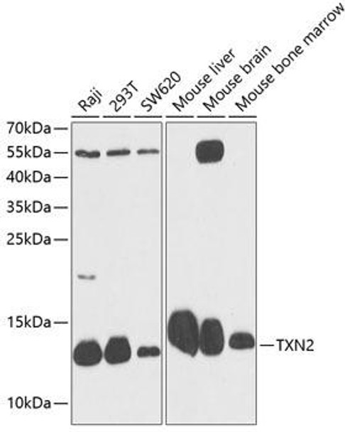 Cell Biology Antibodies 3 Anti-TXN2 Antibody CAB12591