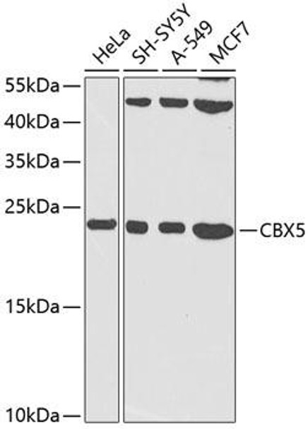 Immunology Antibodies 1 Anti-CBX5 Antibody CAB12592