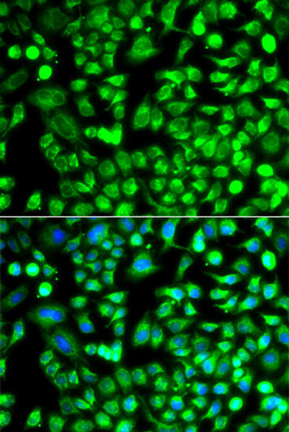 Epigenetics and Nuclear Signaling Antibodies 1 Anti-ALKBH4 Antibody CAB12593