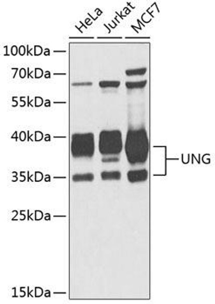 Epigenetics and Nuclear Signaling Antibodies 1 Anti-UNG Antibody CAB1261