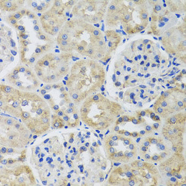 Cell Biology Antibodies 3 Anti-TUBB8 Antibody CAB12617