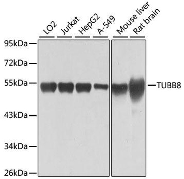 Cell Biology Antibodies 3 Anti-TUBB8 Antibody CAB12617