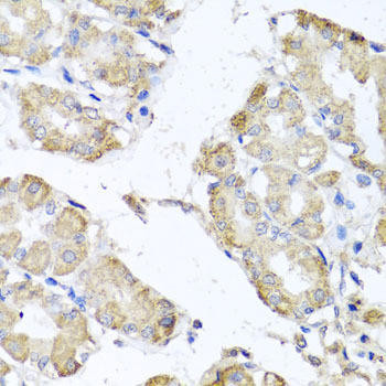 MICA Antibody - Human,Mouse WB, ELISA | Assay Genie