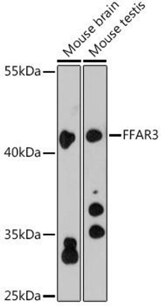 Immunology Antibodies 1 Anti-FFAR3 Antibody CAB12636