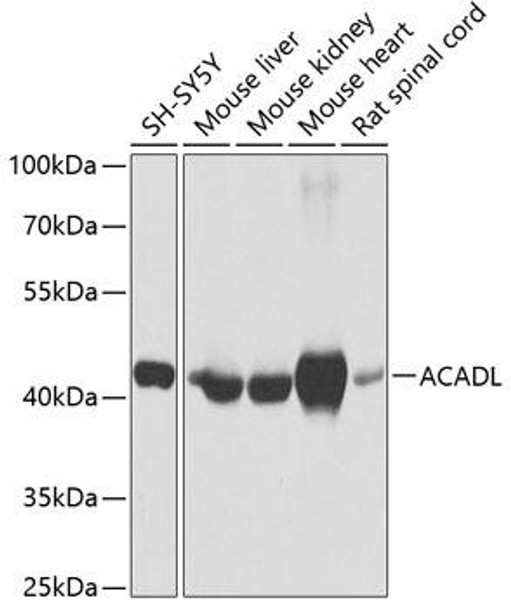 Metabolism Antibodies 1 Anti-ACADL Antibody CAB1266