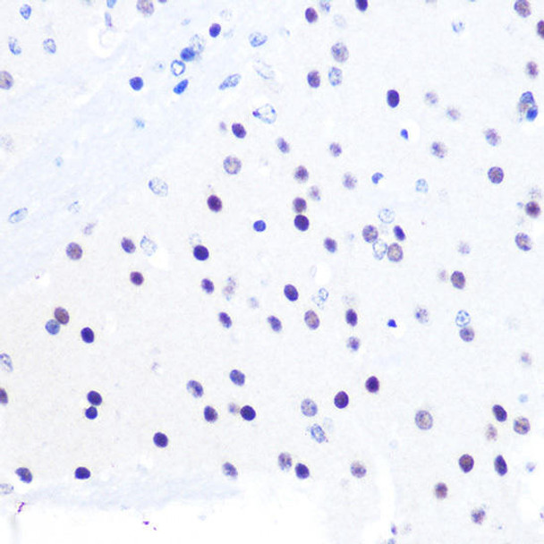 Cell Death Antibodies 1 Anti-PEG3 Antibody CAB12671