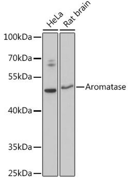 Cell Biology Antibodies 3 Anti-Aromatase Antibody CAB12684