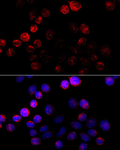 Cell Biology Antibodies 3 Anti-Aromatase Antibody CAB12684