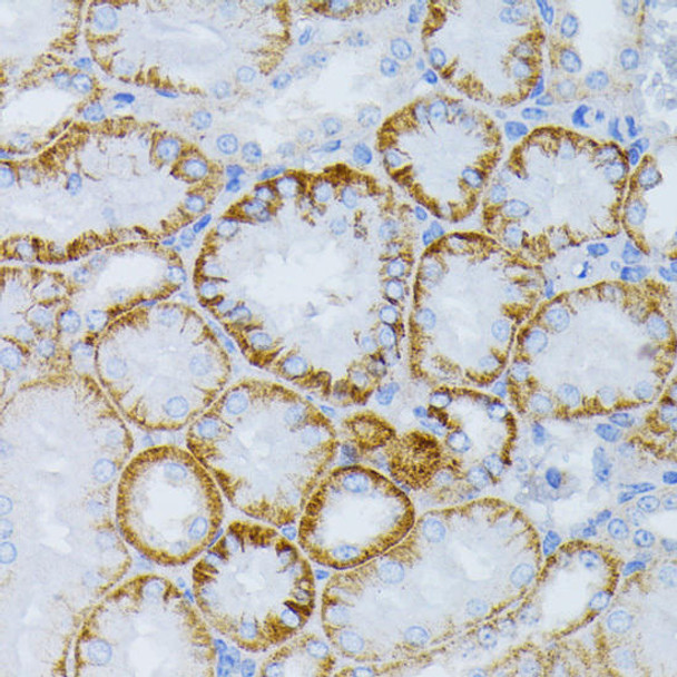 KO Validated Antibodies 1 Anti-MAP2K1 Antibody CAB12687KO Validated