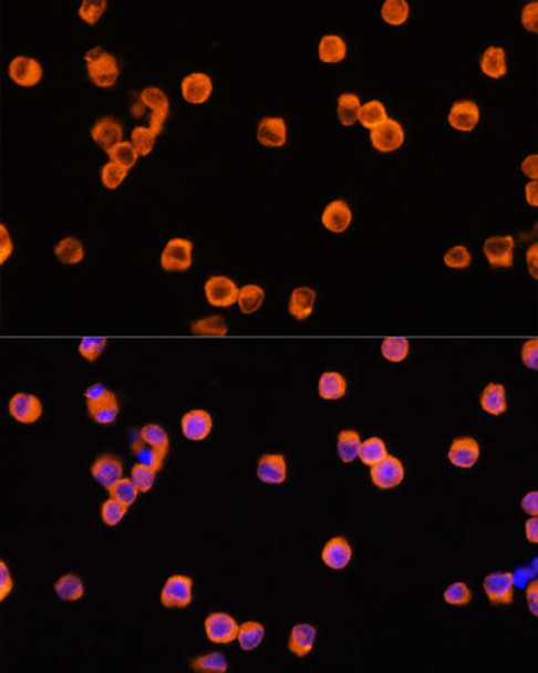 Immunology Antibodies 1 Anti-NLRP3 Antibody CAB12694