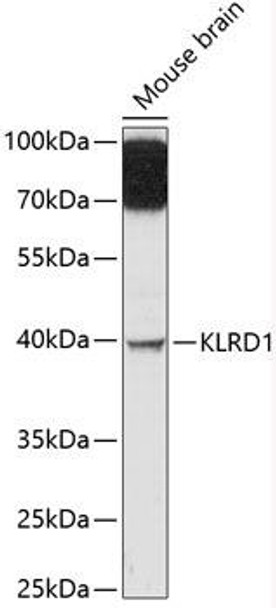 Cell Biology Antibodies 3 Anti-KLRD1 Antibody CAB12698