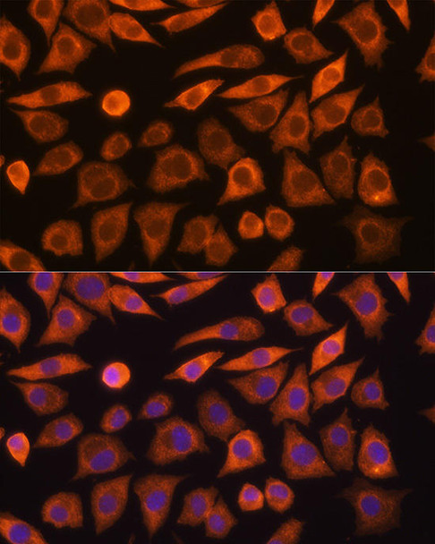 Metabolism Antibodies 1 Anti-GUCY1A3 Antibody CAB12710