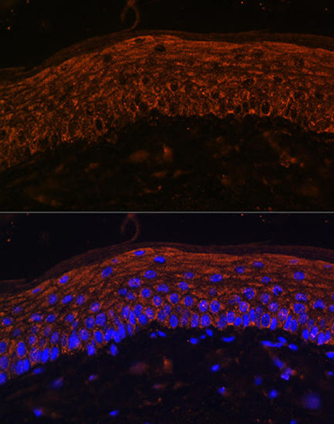 Cell Biology Antibodies 3 Anti-ACKR3 Antibody CAB12712