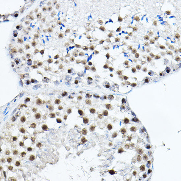 Cell Cycle Antibodies 1 Anti-MDC1 Antibody CAB12714